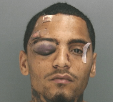 Man beaten by cops: ‘Give me my job back’