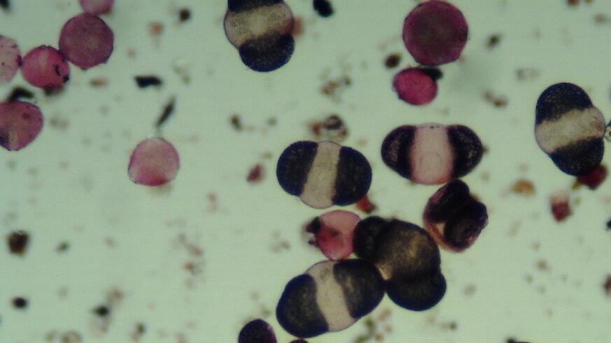 ‘Tis the season of runny noses: Pollen dump sickens locals