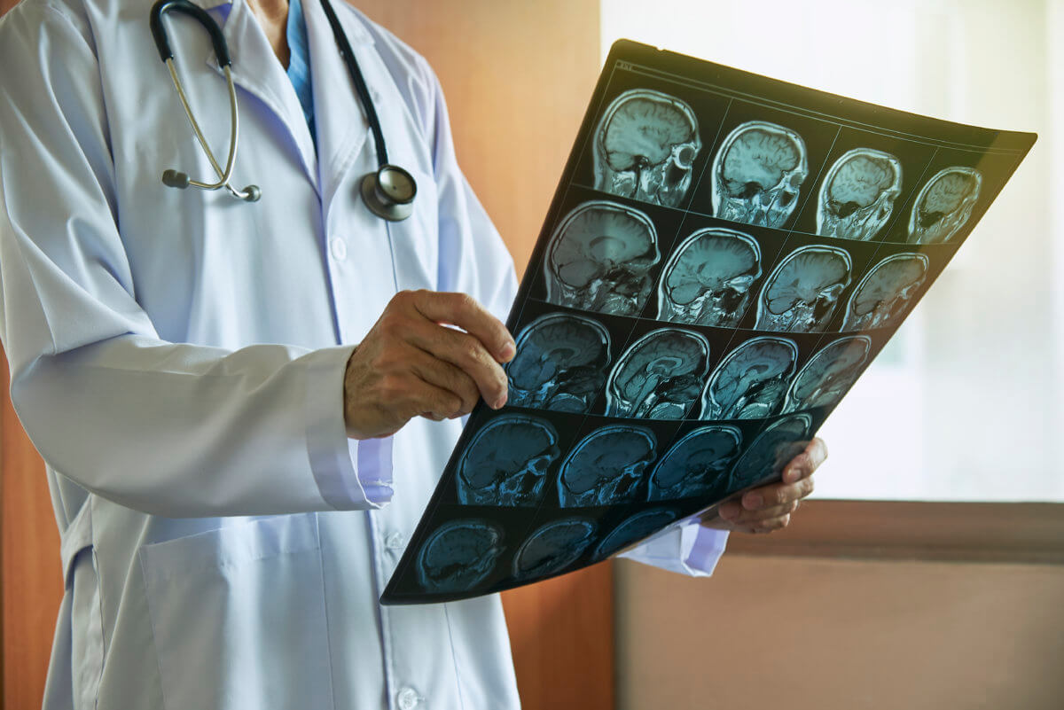 Doctor holding MRI brain in medical office