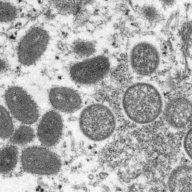 Monkeypox under microscope