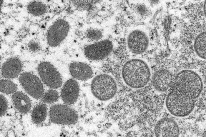 Monkeypox under microscope